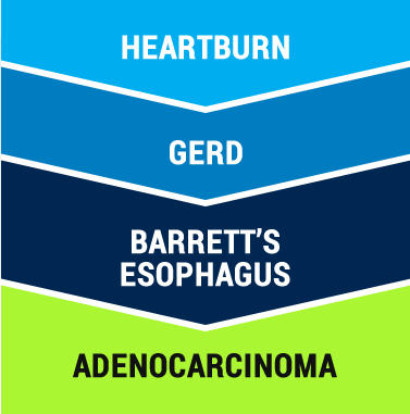 Esophageal Conditions - Gastroenterology Consultants of San Antonio