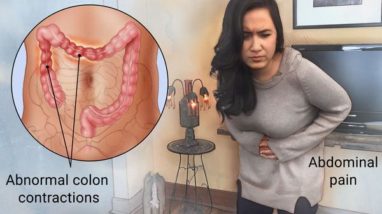 Irritable Bowel Syndrome