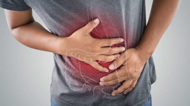 These Colon Cancer Facts May Surprise You