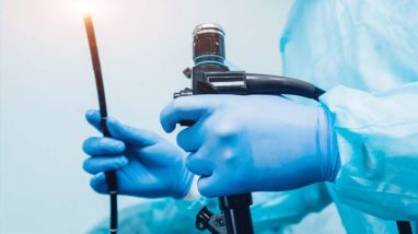 7 Ways an Upper Endoscopy Can Be Beneficial