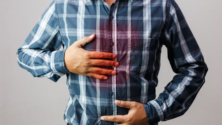 What is Stretta and How Does it Help Heartburn?