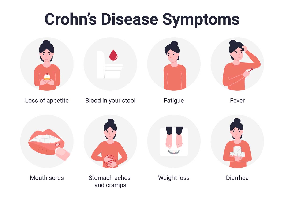 Crohns Disease Symptoms