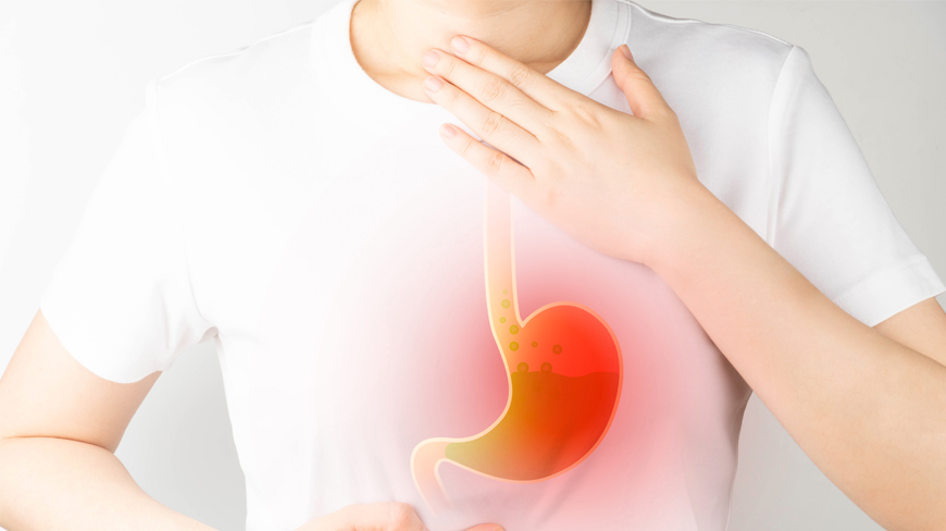 Acid Reflux Diet: Trusted Tips for Relief