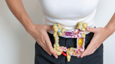 What Happens if a Polyp That Is Removed Contains Cancer?