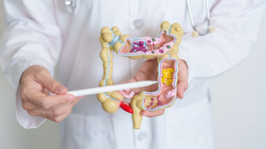 How To Diagnose Colon Cancer: Gastro FAQ