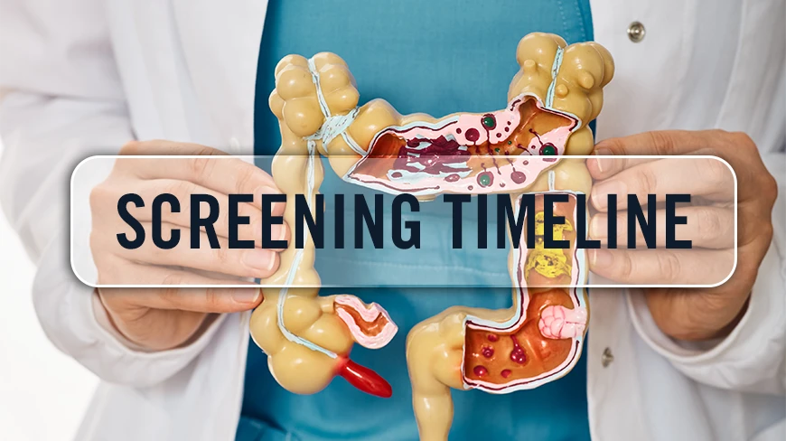 Colon Cancer Screening Timeline: When to Test and What to Expect